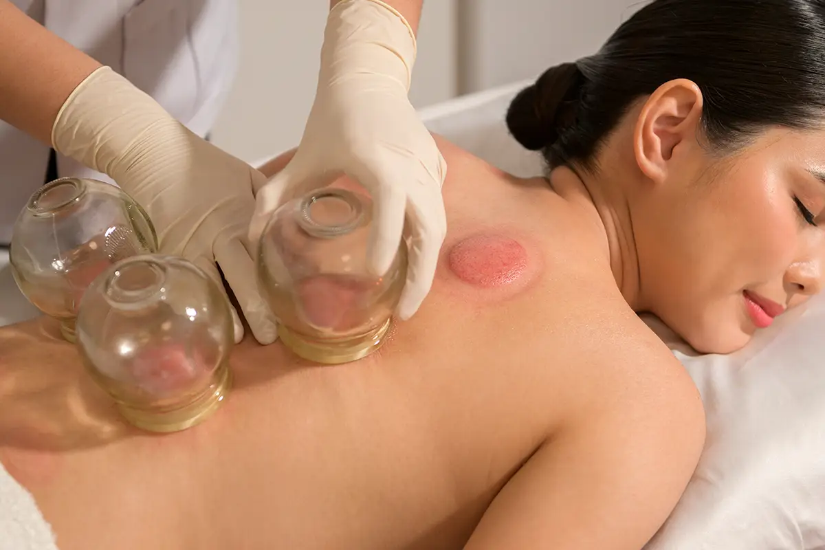 Img - Oneness - Cupping Massage - 1