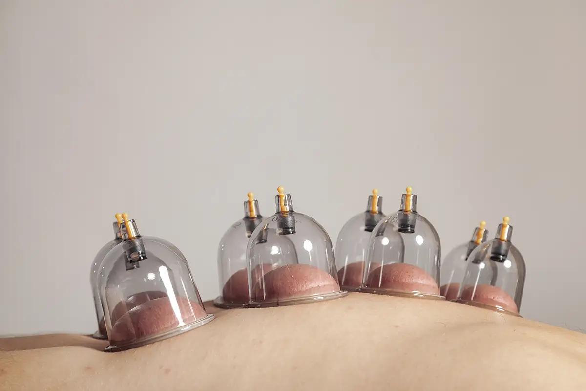 Img - Oneness - Cupping Massage - 2